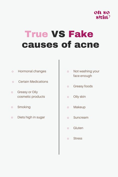 There are many myths around acne, what causes it and how to treat it especially. Here are some of the actual causes of acne, along with some myths to not believe. #skincare #acne #causesofacne #treatacne Skin Knowledge, Treat Hormonal Acne, Acne Prone Skin Care Routine, Causes Of Acne, Different Types Of Acne, Face Mapping Acne, Back Acne, Acne Prone Skin Care, Teen Skincare