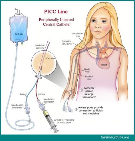 Picc Line Nursing, Central Venous Catheter, Picc Line, Iv Line, Nursing School Essential, Child Life Specialist, Nurse Study Notes, Nursing Student Tips, Medical Student Study