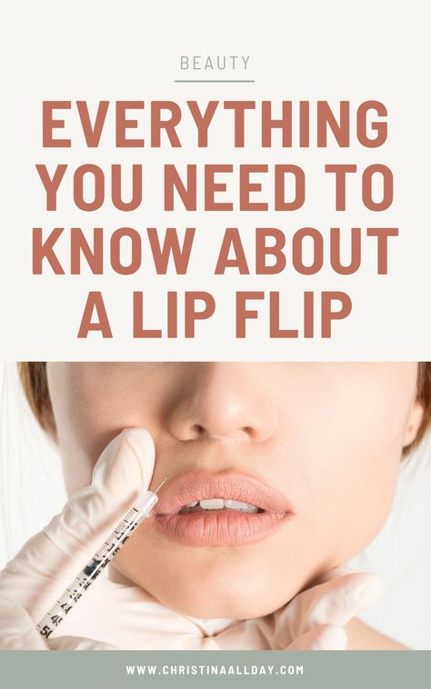 What Is A Lip Flip, City Lips Before And After, First Time Lip Fillers, Lip Flip Results, Lip Botox Before And After, Lip Flip Botox Injection Sites, Down Turned Lips, Esthetic Nursing, Lip Flip Vs Filler