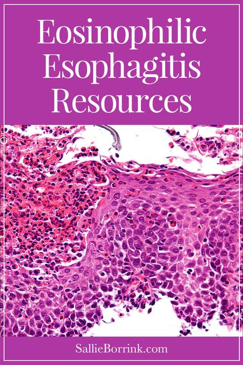 Understanding Eosinophilic Esophagitis and Resources - Sallie Borrink Eosinophils High, Eosinophilic Esophagus Diet, Esophagus Problems, Eosinophilic Esophagus, Eoe Disease, Eoe Diet, Inflammatory Meals, Dad In Heaven Quotes, Healthy Stomach