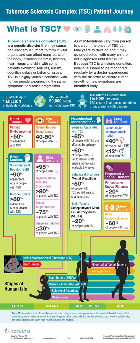 Tuberous Sclerosis Complex (TSC) Patient Journey Infographic Journey Infographic, Tuberous Sclerosis, Warrior Training, Genetic Disorders, Heart And Lungs, Kidney Health, Rare Disease, Get Educated, Neurology