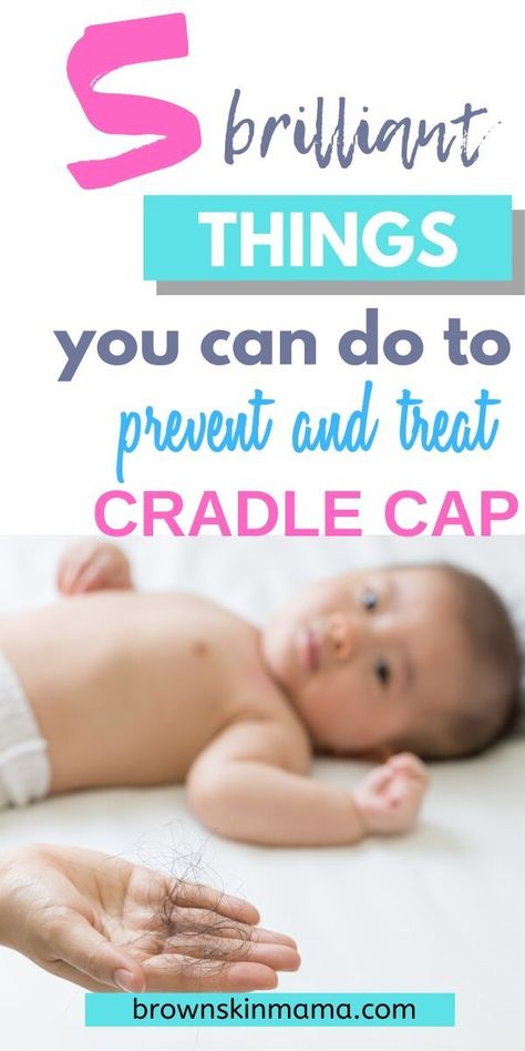 Lear how to get rid of and prevent further bouts of cradle cap attacking your baby's hair.  These tips will help you to treat the problem and keep it under control #newbaby #brownskinmama #newmomtips How To Get Rid Of Cradle Cap, Grow Baby Hair, Cradle Cap Remedies, Baby Cradle Cap, Taking Care Of Baby, Cap Baby, Cradle Cap, Flaky Scalp, Baby Planning