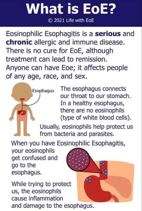 Eosinophilic Esophagus Diet, Eosinophilic Esophagus, Eoe Disease, Eosinophilic Asthma, Eoe Recipes, Eoe Diet, Crps Awareness, Food Allergies Awareness, Coeliac Disease