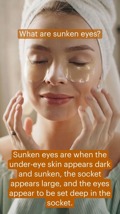 #FaceWashForBrownSpots Sunken Eyes Remedy Natural, Sunken Eyes Remedy, Brown Spots On Hands, Brown Age Spots, Sunken Eyes, Brown Spots On Skin, Brown Spots Removal, Bff Drawings, Brown Spots On Face