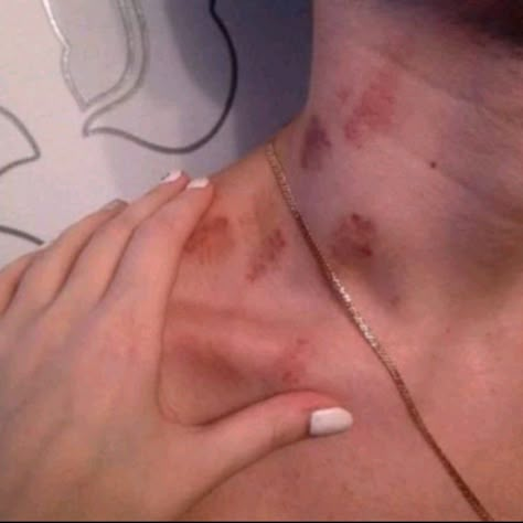 Hickies Neck, Wanna Recreate, Dream Relationship, Me N Who, Couple Stuff, Couples Vibe, Could Be Us, Cute Relationship Photos, My Kind Of Love