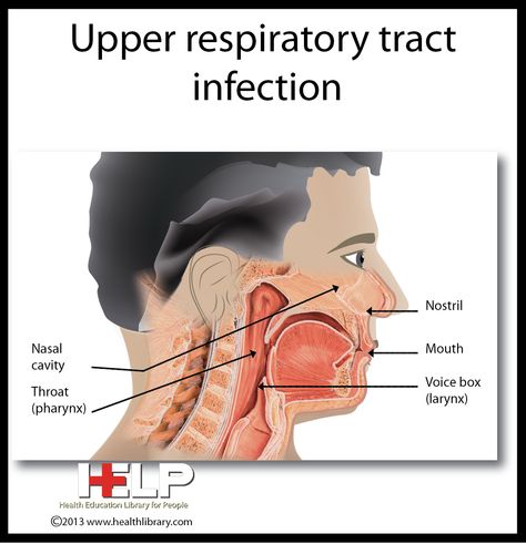 Upper Respiratory Tract Infection Upper Respiratory Tract, Natural Decongestant, Human Body Temperature, Upper Respiratory Infection, Lip Care Routine, Respiratory System, School Project, Lungs, Respiratory