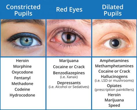 Drug Eye Pupil Dilation, Dilated Eyes, Emt Study, Dilated Pupils, Medical Student Study, Pharmacology Nursing, Nursing School Survival, Nursing School Studying, Medical Facts