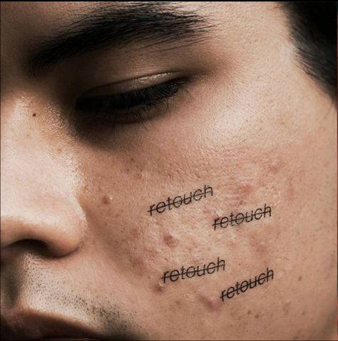 "Retouch," Peter DeVito, 20, a photographer from New York, used to heavily Photoshop his own pictures but has since stopped to create a powerful movement online. Artist: Peter DeVito Peter Devito, Acne Help, Skin Model, Ex Machina, Foto Art, Beauty Standards, Tan Skin, Photography Projects, Insta Photo