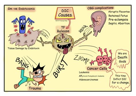 Disseminated Intravascular Coagulation - Creative Med Doses Disseminated Intravascular Coagulation, Prothrombin Time, D Dimer, Clinical Chemistry, Nursing Fun, Nursing Cheat, Addisons Disease, Pa School, Pharmacology Nursing