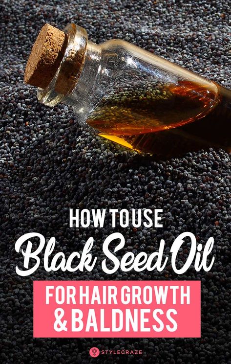 How To Use Black Seed Oil (Kalonji) For Hair Growth And Baldness Home Made Hair Oil For Hair Growth, Black Seed Oil Hair Growth, Kalonji Benefits, Kalonji Seeds For Hair Growth, Black Seed Oil Benefits Hair, Blackseed Hair Oil, Kalonji Oil For Hair, How To Make Black Cumin Seed Oil, Black Cumin Seed Oil Benefits