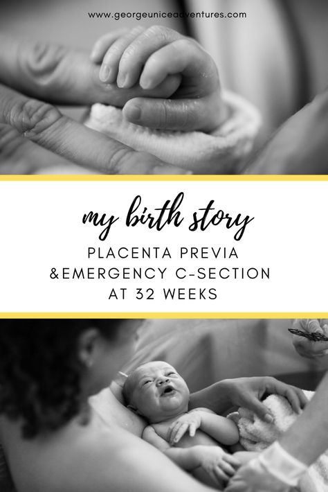 Pin on Family Blog | georgeuniceadventures Trouble Getting Pregnant, Getting Pregnant Tips, Emergency C Section, To Pee, Birth Story, Third Trimester, C Section, Birth Stories, Pregnancy Birth