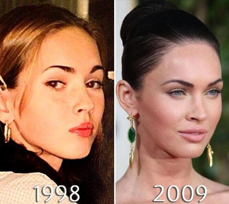 Megan Fox Before Surgery, Brooke Shields Face, Face App, Brooke Shields, After Photos, Megan Fox, Plastic Surgery, Surgery, Art Inspiration