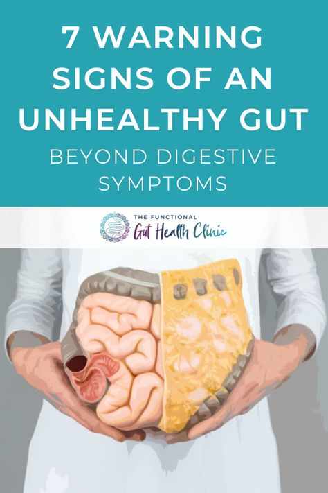 Poor Gut Health Symptoms, Heal Digestive System, Diet To Improve Gut Health, Gut Healing Journey, Signs Of Poor Gut Health, Irritable Bowel Disease Symptoms, Gut Recipes, Irritable Bowel Disease, Gut Problems