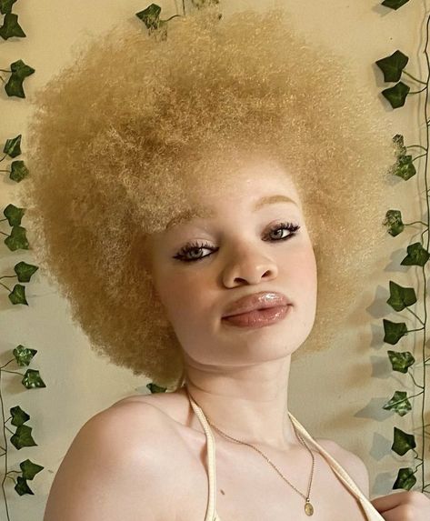 Black Woman with Albinism Pretty Albino Girl, Albino Girl Black, Black Albino Women, Albino Black Woman, Albino Woman, Albino People, Albino Model, Albino Girl, Jheri Curl