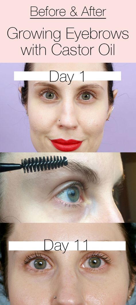 Can you DIY growing your eyebrows out with castor oil? I tried for 11 days and my results will shock you! Click above to see the type of castor oil I used and watch my progress from day 1 to day 11. How To Apply Castor Oil To Eyelashes, Castor Oil For Eyelash Growth, Castor Oil For Hair Growth Eyebrows, Castor Oil On Eyelashes, Eyelash Castor Oil, Castor Oil On Eyebrows, Oils For Eyebrow Growth, Castor Oil For Eyebrows, Castor Oil For Lashes Before And After