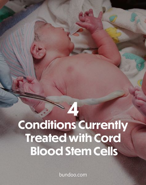 Newborn Umbilical Cord Care, Cord Blood Banking, Umbilical Cord, First Trimester, Trying To Conceive, Stem Cells, Banking, Disease, Labor