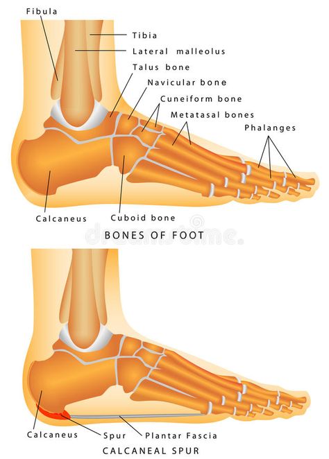 Heel Spur. Bones of the Foot and Ankle. Calcaneal spur. Calcaneal spur a bone ex , #ad, #Foot, #Ankle, #Calcaneal, #Heel, #Spur #ad Heal Spurs, Calcaneal Spur, Good Work Boots, Ligaments And Tendons, Natural Sleep Remedies, Joints Pain Relief, Heel Pain, Natural Sleep, Foot Health