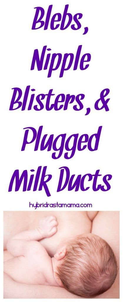 Milk Blister, Clogged Milk Duct, How To Heal Blisters, Blood Blister, Holistic Pet Care, Human Milk, Habits Of Successful People, Breast Health, Breastfeeding And Pumping