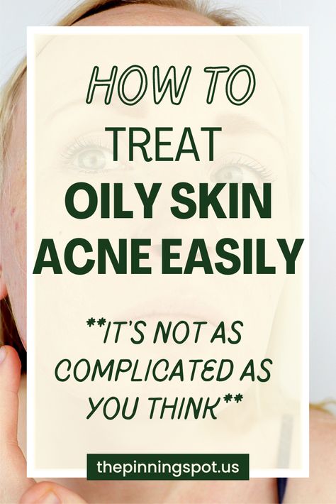 How to treat acne. If you have acne caused by oily skin, then here's a post to show you how to treat acne and keep your oily skin acne free. How To Get Rid Of Oily Skin, Treat Oily Skin, Get Rid Of Oily Skin, Oily Skin Remedy, Acne Products, Oily Skin Acne, Hormonal Balance, Acne Causes, Treat Acne