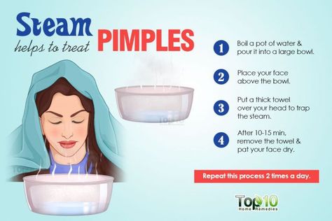 Home Remedies for Pimples | Top 10 Home Remedies Home Remedies For Pimples, Bad Acne, Pimples Remedies, Natural Acne Remedies, Natural Acne, Acne Scar Removal, Homemade Diy, Cystic Acne, Acne Remedies