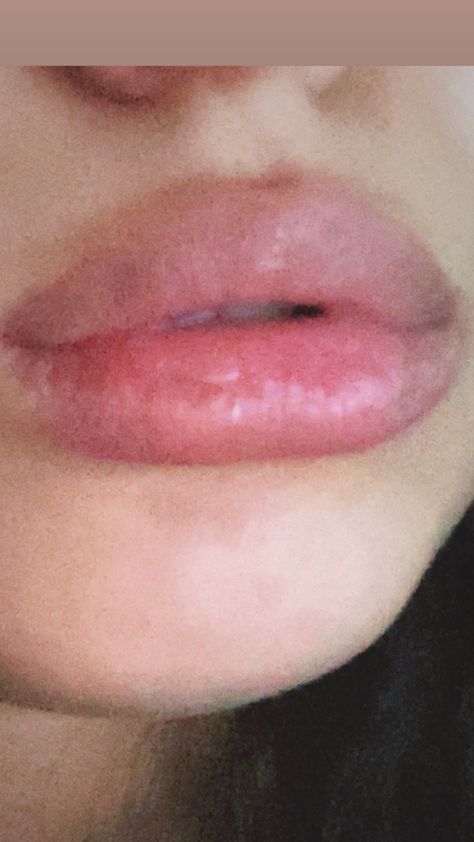 Lips, big lips, pink lips, natural lips #pinklips #lips #naturallips #tumblrlips#lipstick Big Natural Lips, Naturally Big Lips, Heavy Bottom Lip, How To Get Big Lips Naturally, Pretty Lips Natural, Heavy Upper Lip, Big Lips Girl, Flushed Lips, Big Lips Aesthetic