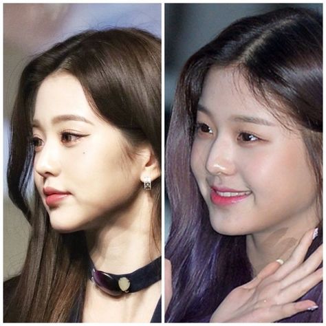 Wonyoung Lip Filler, Haerin Barefaced, Kpop Plastic Surgery, V Line Surgery, Plastic Surgery Fail, Plastic Surgery Gone Wrong, Face Surgery, Cheek Fillers, Nose Surgery