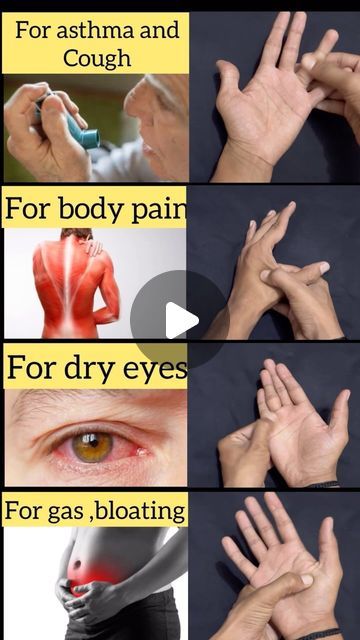 Acupressure Points For Blocked Nose, Hand Pressure Points, Pressure Point Therapy, Chinese Massage, Massage Points, Hand Reflexology, Massage Therapy Techniques, Reflexology Chart, Acupressure Therapy