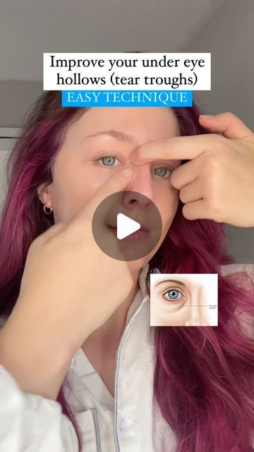 Under Eye Hollows, Tension Release, Massage Routine, Eye Massage, Drinking Enough Water, Tear Trough, Sleeping Well, Lymph Drainage, Beauty Hacks Skincare