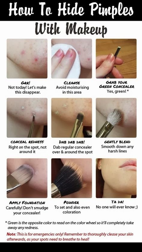 Pimple Coverage Makeup, Hide Pimples With Makeup, How To Hide Pimples, Green Concealer, Opposite Colors, Make Up Tutorial, My Wedding Day, How To Apply Foundation, Powder Foundation