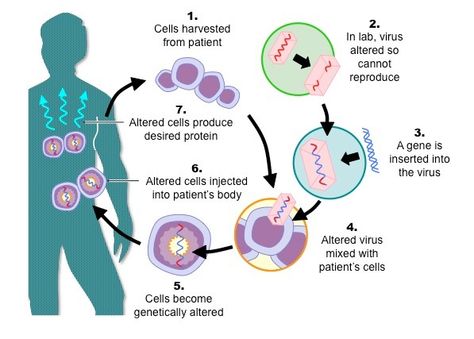 Gene therapy in a nutshell Therapy Notes, Gene Therapy, Drawing People Faces, Science Notes, Biotechnology, Microbiology, In A Nutshell, Science And Nature, Science