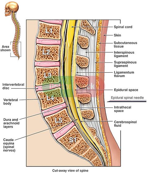 This illustration series depicts the anatomy of the lumbosacral (lumbar and sacral) spine from a mid-sagittal cut-away view with an epidural needle poised outside the skin at the L4-5 interspace. Description from doctorstock.photoshelter.com. I searched for this on bing.com/images Epidural Needle, Spinal Cord Anatomy, Peripheral Nerve Injury, L5 S1, Cauda Equina, Skin Anatomy, Lumbar Disc, Intervertebral Disc, Bolesti Chrbta