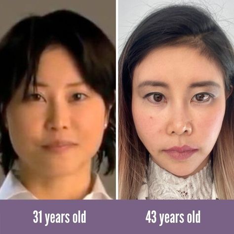 KOKO FACE YOGA on Instagram: "Today's #transformationtuesday features our very own Koko Hayashi! Can you believe the difference? 😱 Share your favorite before and after photos 👇 #kokohayashi #kokofaceyoga #faceyoga #beforeafter #transformation #transformationtuesday #glowup #glowupchallenge #beauty #faceyogaexpert #faceyogamethod #faceyogateacher #faceyogainstructor" Koko Face Yoga, Face Yoga Before And After, Face Yoga Method, Yoga Short, Transformation Tuesday, Face Massage, Face Yoga, Yoga Teacher, Massage