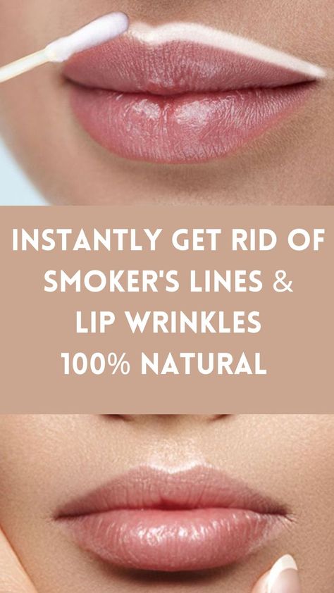 Beauty Industry Experts Agree This is a Great Solution for Younger, Plumper Looking Lips! Laney Wilson Hair, Fuller Lips Naturally, Smokers Lines, Plump Lips Naturally, Moisturizing Routine, Remove Eye Bags, Wrinkle Remedies, Spf Lip Balm, Lip Wrinkles