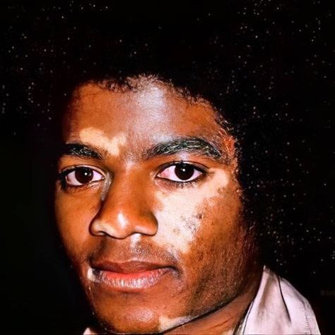 Michael Jackson Skin, Facts About Michael Jackson, Young Michael Jackson, Michael Jackson Live, Michael Jackson Images, Michael Jackson Photoshoot, Mike Jackson, Michael Jackson Funny, Girl Gang Aesthetic