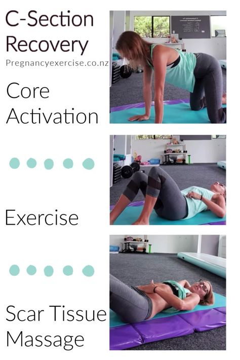 C Section Exercise Recovery, C Section Recovery Exercise Workouts, C Section Core Recovery, Post C Section Workout Plan, C Section Recovery Workout, Post Cesarean Workout Exercises, Workouts After C Section, C Section Exercise Workouts, C Section Recovery Exercise