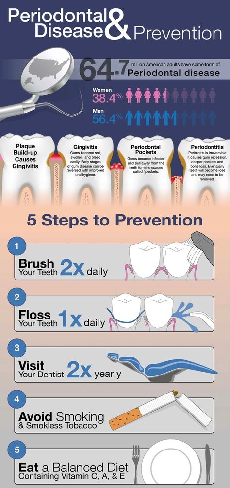 Periodontal Disease Infographic! Kedokteran Gigi, Dental Facts, Tooth Pain, Periodontal Disease, Dental Humor, Oral Health Care, Disease Prevention, Dental Hygiene, Tooth Decay