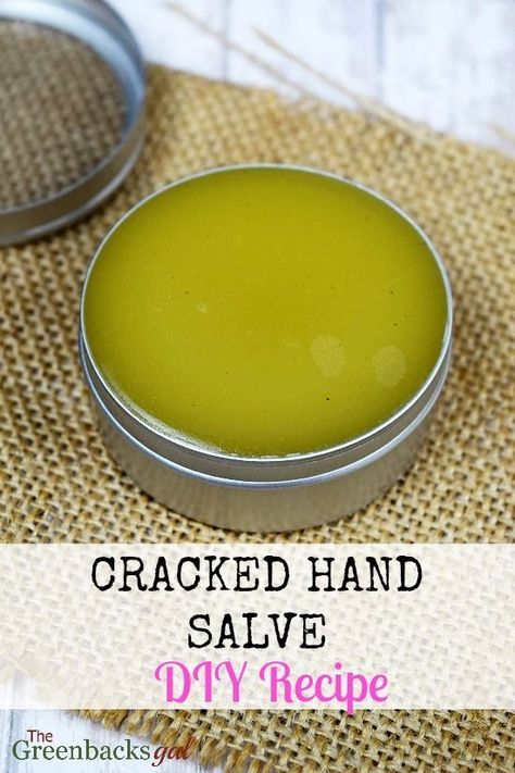 Hand Cream Homemade, Salve Recipes, Hand Salve, Cracked Hands, Diy Lotion, Diy Kosmetik, Homemade Lotion, Hand Creams, Diy Recipe