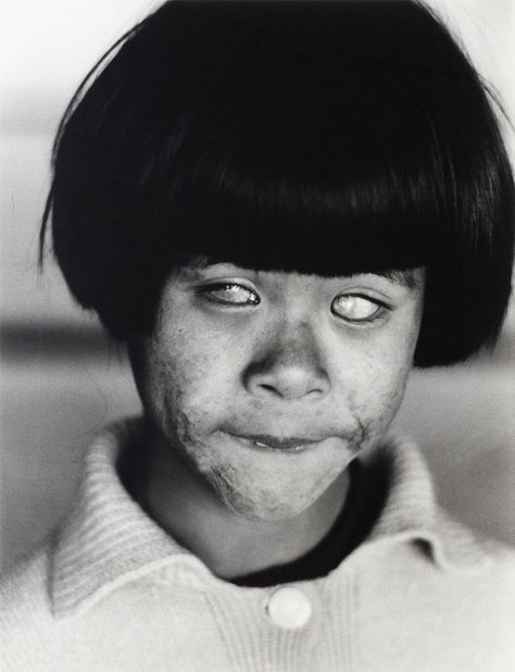 On July 26, 1945, the Allies delivered the Potsdam Declaration to the leaders of Japan, which they rejected. Six days after the bombing of Nagasaki, they accepted the exact same terms. I wish they hadn't waited ... James Nachtwey, Hiroshima Nagasaki, A Thousand Suns, Nuclear Blast, Blind Girl, Creepy Photos, Hiroshima Japan, Steve Mccurry, Robert Doisneau