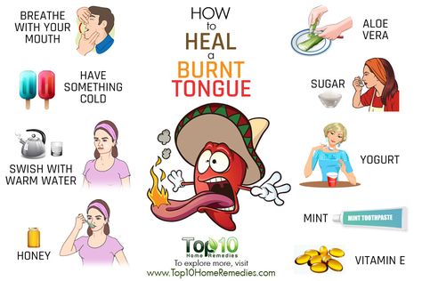 how to heal a burnt tongue Tongue Burn Remedies, Burnt Tongue Remedies, Burnt Tongue, Honey Remedies, Top 10 Home Remedies, Tongue Health, Health Hacks, Nail Care Tips, Nail Health