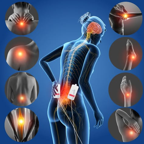 How TENS can manage your pain, drug-free. – ITOUCH-SA Hospital Images, Content Pictures, Dental Images, Referred Pain, Tens Machine, Body Alignment, Spinal Nerve, Human Organ, Back Pain Remedies