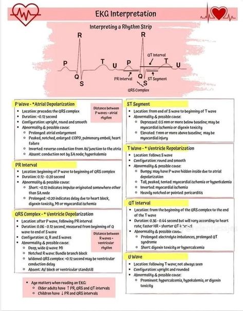 Cardiac Monitor Tech, 12 Lead Ekg Placement Cheat Sheets, Heart Anatomy Notes, Ekg Interpretation Made Easy, Cardiac Nursing Cheat Sheets, Charting For Nurses, Nursing School Studying Cheat Sheets, Cardiology Nursing, Ecg Interpretation