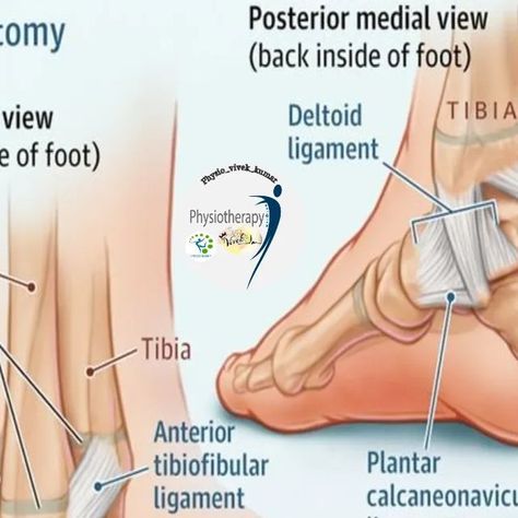 physio Vivek Kumar(10k)🎯 on Instagram: "Ankle sprains are among the most common injuries experienced by young athletes. A sprain is a type of injury in which the ligaments that connect bones together are partially or completely torn. There are several ligaments in the ankle that can be injured, but by far the most common are the ligaments that connect the fibula (shin bone), calcaneus (heel bone), and talus (foot bone). These ligaments are on the outside of the ankle. Less commonly, the ligaments on the inside of the ankle can be torn. In general, injuries to all of these ligaments (including complete tears) heal quickly on their own. However, there are some treatments that can improve comfort and might speed recovery. First, it is important to protect the joint from further injury. Whe Torn Ligament In Ankle, Ankle Anatomy, Ligament Tear, Sprained Ankle, Young Athletes, Human Anatomy, Anatomy, Bones, Healing