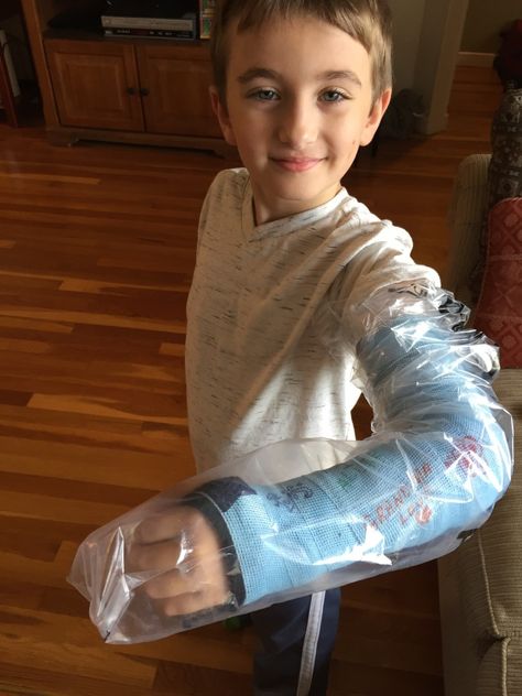 Parenting Tips To Help A Child With A Broken Bone - Unboxed Mom Broken Arm Cast, Broken Elbow, Kids Dinners, Arm Cast, Leg Cast, Broken Arm, Mom Guilt, Broken Leg, Modern Kids