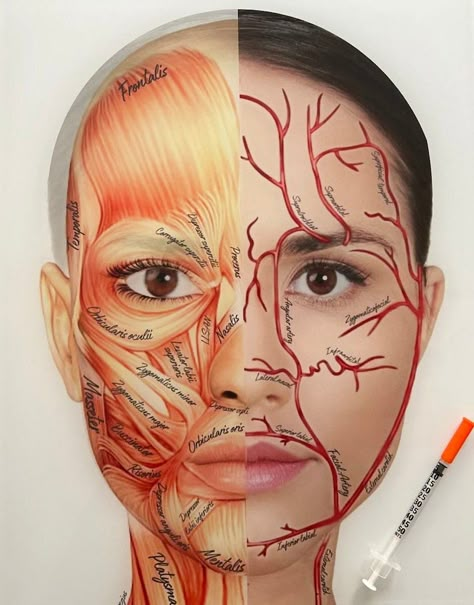 Facial Artery Anatomy, Facial Anatomy For Injectors, Anatomy Of The Face, Facial Muscles Anatomy, Aesthetic Injector, Nose Surgery Rhinoplasty, Anatomy Education, Aesthetic Training, Medical Aesthetician