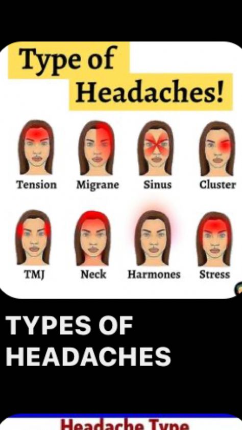 Headache Meaning, Headache Location, Different Headaches, Drink A Lot Of Water, Home Remedy For Headache, Air Wrap, Headache Types, Sinus Headache, Headache Prevention