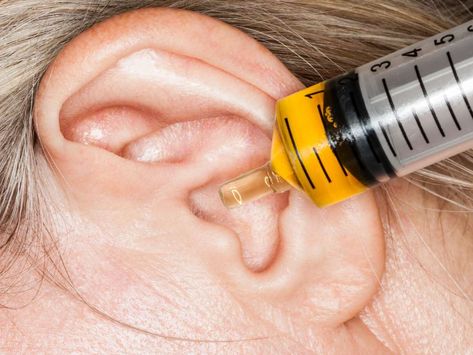 Ear Remedies Clogged, Ear Irrigation Diy, Clogged Ears Remedy, Essential Oil For Clogged Ear, Home Remedy For Ear Wax Build Up, Ear Congestion Relief Sinus Infection, Clogged Ears From Allergies, Fluid In Ear Remedy Sinus Infection, Dry Ears Remedy