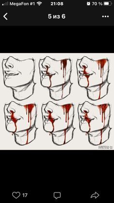 Injury Drawing Reference, Poses Art Reference, To Draw Ideas, Poses Art, 2022 Art, Draw Ideas, Blood Art, Body Reference Drawing, Drawing Expressions