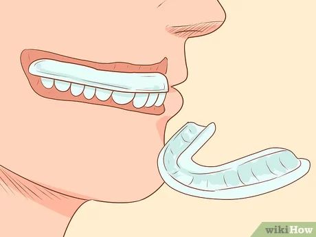 3 Ways to Grow Gums Back - wikiHow Gum Health Remedies, Teeth Gums Receding, Receding Gums Remedies, Sore Gums Remedy, How To Heal Your Gums, How To Grow Your Gums Back, Heal Receding Gums Naturally, How To Reverse Receding Gums, How To Heal Gums Naturally