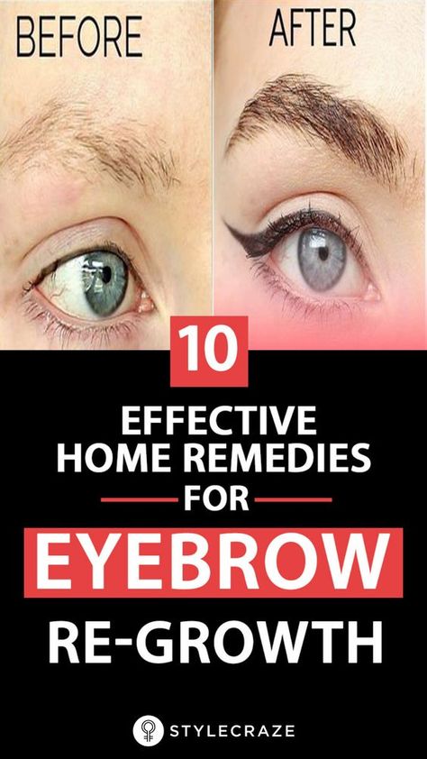 10 Effective Home Remedies For Eyebrow Re-Growth Eyebrow Growth Remedies, Thinning Eyebrows, Eyebrow Regrowth, Regrow Eyebrows, Eyebrow Hair Growth, Natural Eyebrows Growth, Grow Eyebrows Thicker, Shaped Eyebrows, Fuller Eyebrows