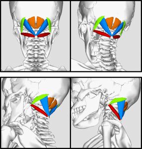 Suboccipital Muscles, Cervicogenic Headache, Daily Headaches, Neck Problems, Chronic Migraines, Strengthening Exercises, Migraine Headaches, Shoulder Pain, Health Check